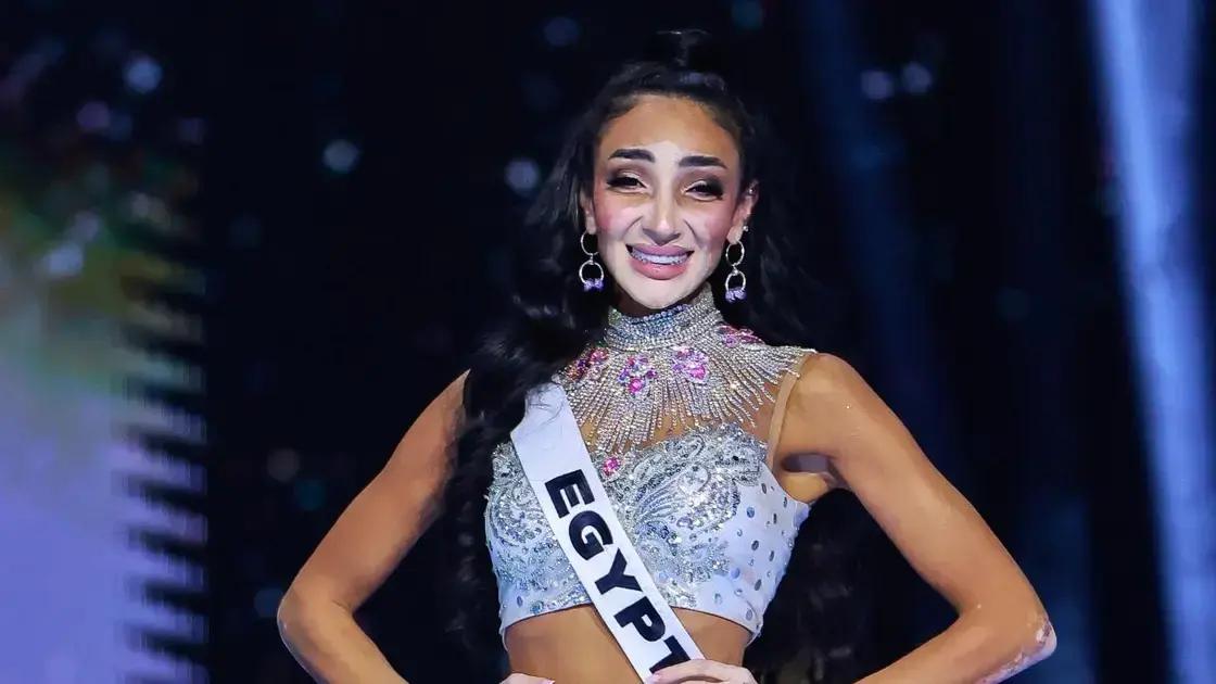 Miss Universo: 1ª candidata com vitiligo faz história